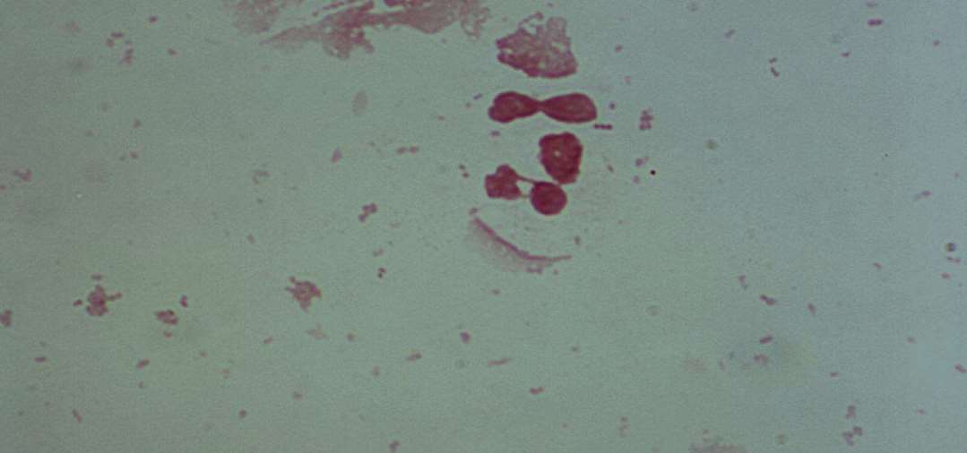 Mouse Anti-Chick Type I Collagen IgG Antibody Assay Kit, TMB