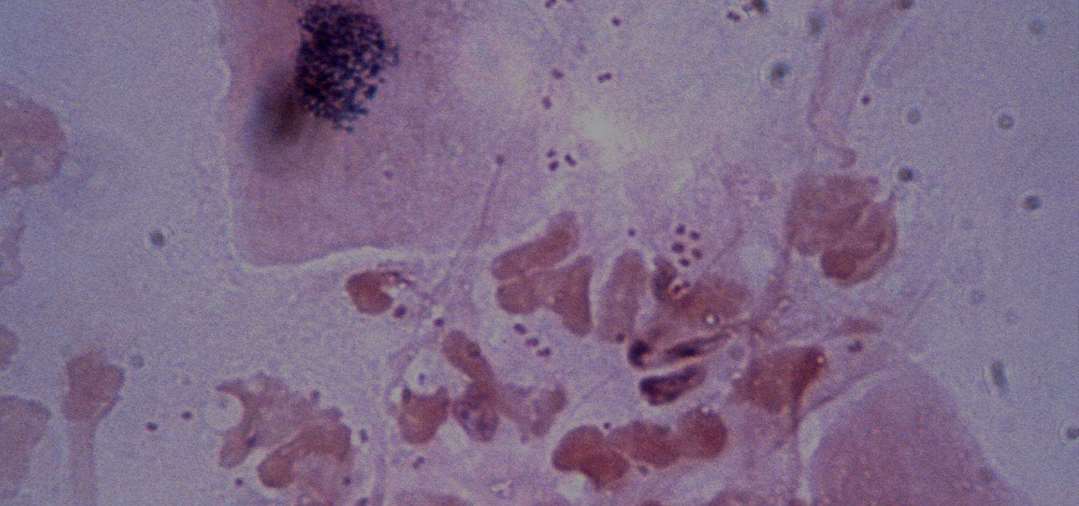 Mouse Anti-Rabbit IgG Antibody (H+L), Biotin Conjugated